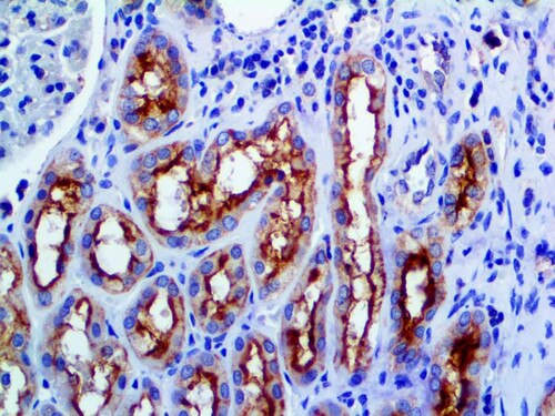 IHC of MDR-1 on a FFPE Kidney Tissue